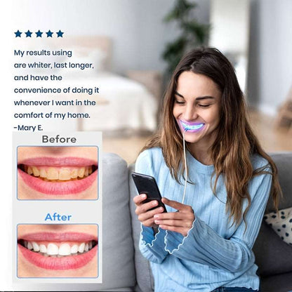 Advanced Teeth Whitening Kit with LED Light: Say Goodbye to Stains